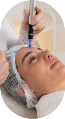 Microneedling